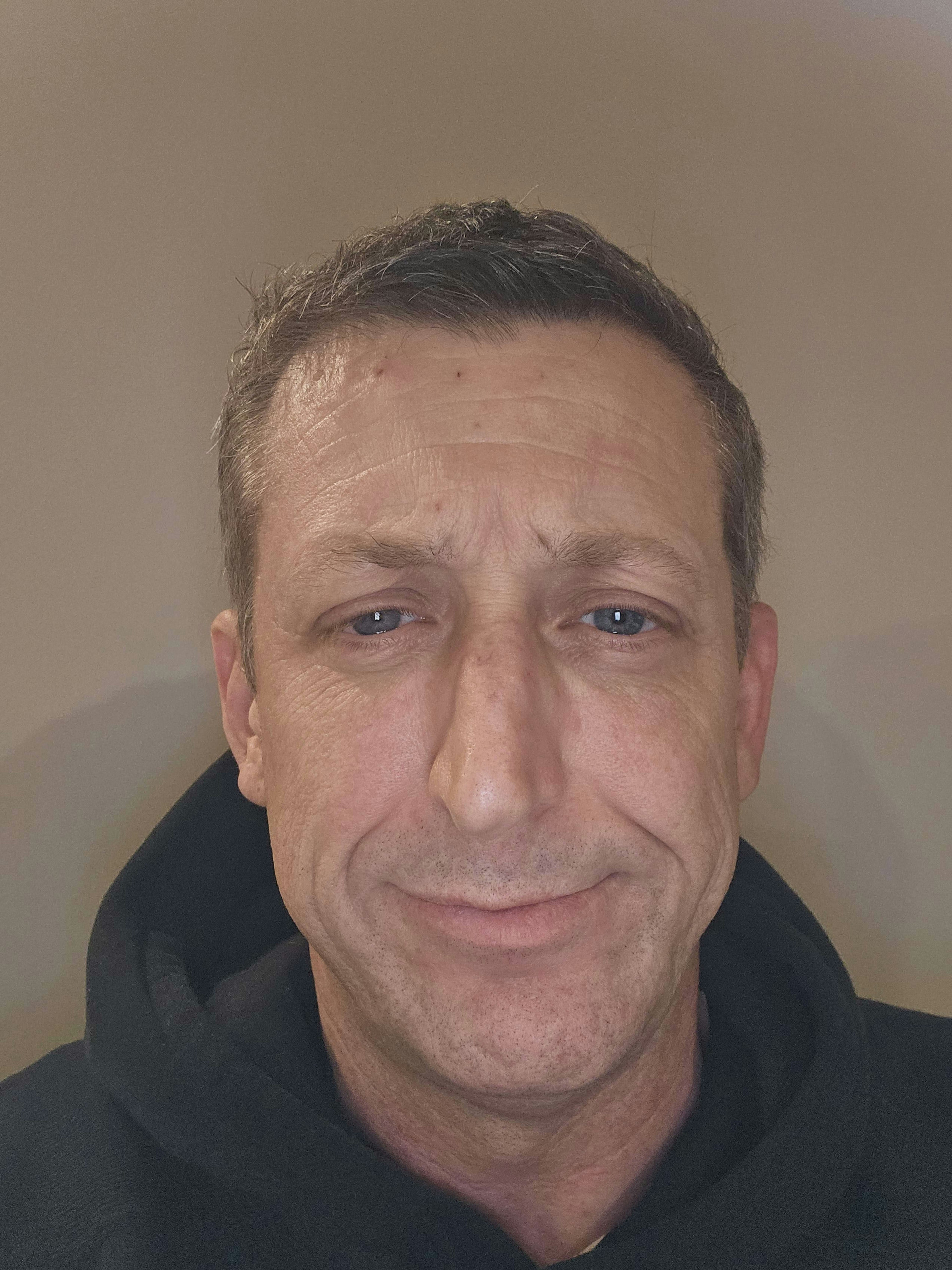 jasonremingtonbaseeth